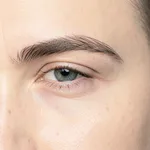 Eyebrow Transplant FUE - Natural Dense Look