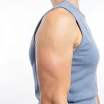 Mini Arm Lift - Limited Incision Technique