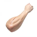 Arm Lift Brachioplasty - Upper Arm Reshaping