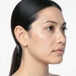 Ear Pinning Otoplasty - Prominent Ear Correction