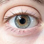 Toric IOL Lens - Astigmatism & Vision Correction