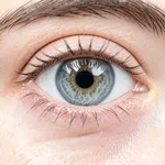 Premium Multifocal Lens Replacement - Both Eyes