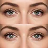 Eyelid Surgery