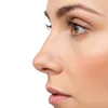 Rhinoplasty