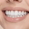 Teeth Whitening
