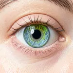 Laser Eye Color Change - Lumineyes Technology