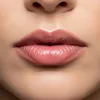 Lip Augmentation