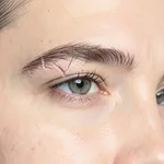 Eyebrow Restoration - Scar & Gap Repair
